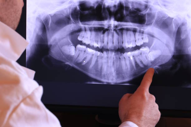 Best Emergency Denture Repair in Bethpage, NY